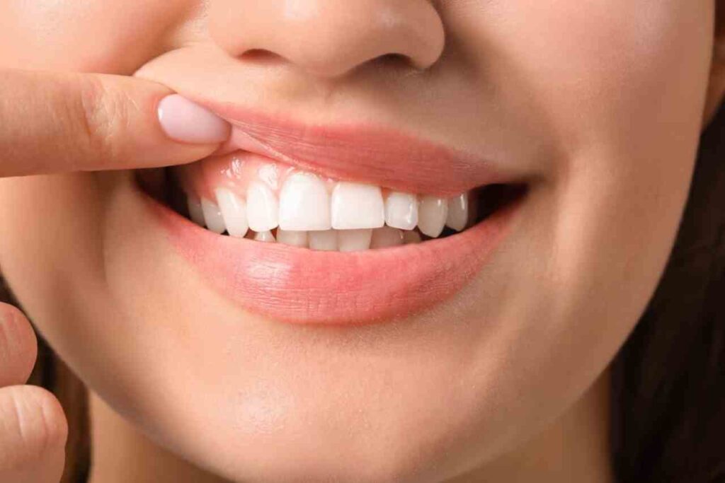 abitudini che danneggiano i tuoi denti